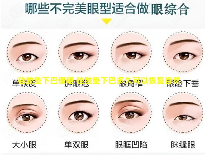 硅胶垫下巴僵硬 硅胶垫下巴多久可以恢复自然